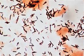 Lactobacillus acidophilus
