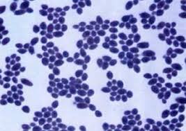 Saccharomyces boulardii